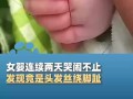 女婴两天哭闹不止竟因头发丝绕脚趾 回顾事情始末！
