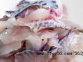 河南5人吃生鱼片全部确诊肝吸虫病 从“胃肠炎”到39.2℃高烧，4人肝功能受损