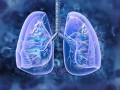 ☩钟南山团队发现71%肺结节患者不吸烟,女性风险更需警惕!
